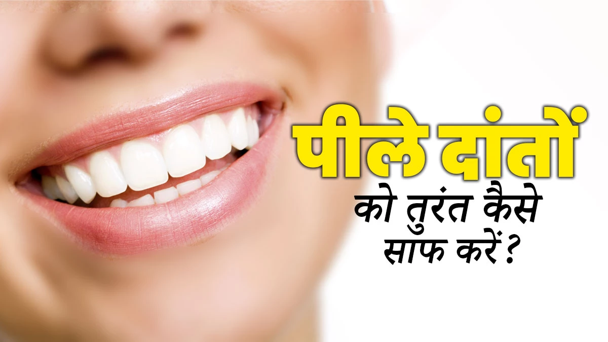 दांतों का पीलापन होगा जड़ से खत्म, अपनाएं ये 5 घरेलू नुस्खे; हफ्तेभर में चमक जाएगी बत्तीसी