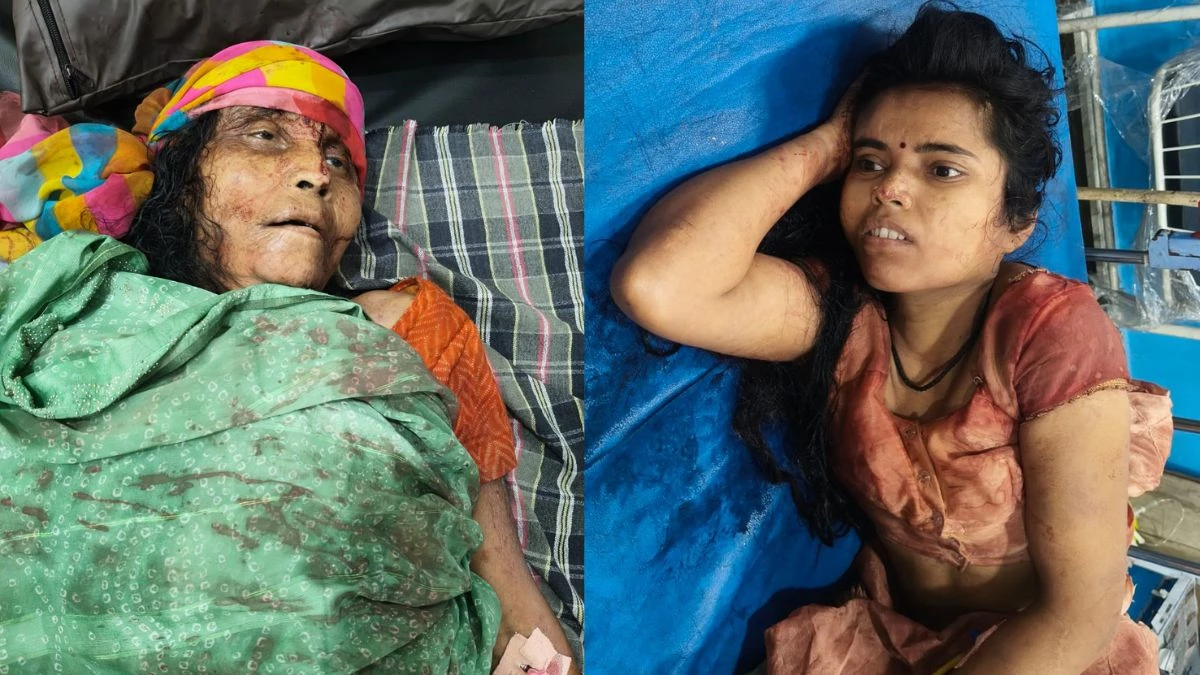 जर्मन शेफर्ड कुत्ता खरीदने के लिए नहीं दिए 200 रुपए तो बेटे मां को उतार दिया मौत के घाट, हथौड़े के हमले से पत्नी भी घायल