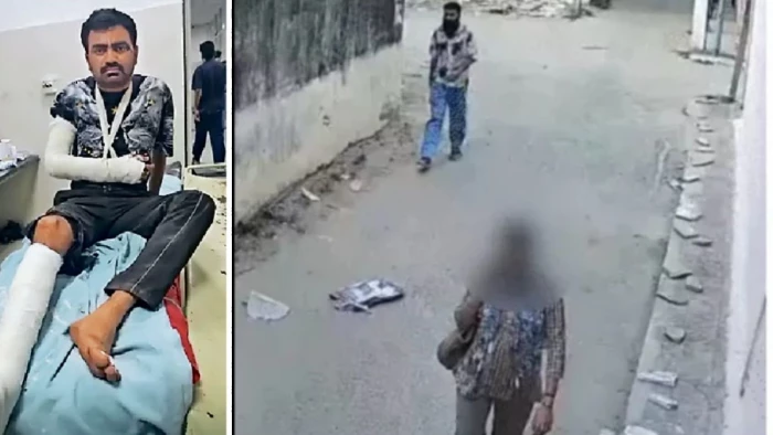 जयपुर में महिला से छेड़छाड़ करने वाला बदमाश भागने में गिरा, टूटे हाथ-पैर