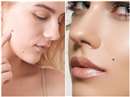 Mole Marks: जानिए क्या कहते हैं आपके नाक, कान, होंठ और चेहरे पर बने तिल के निशान