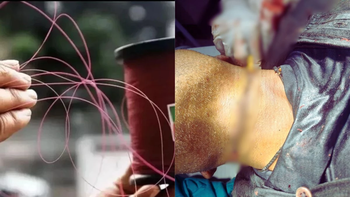 'मौत की डोर' से उज्जैन और मंदसौर में एक ही दिन चार लोगों की गर्दन व किशोर का गाल कटा; गैरेज संचालक को लगे 20 टांके