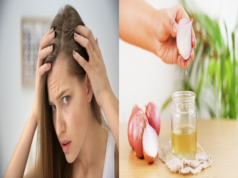 Onion Benefits: क्या आप बालों के झड़ने से परेशान हैं तो आजमाएं घर का बना  प्याज का तेल मिलेंगे कई फायदें - Onion benefits suffering from hair loss  try this homemade onion