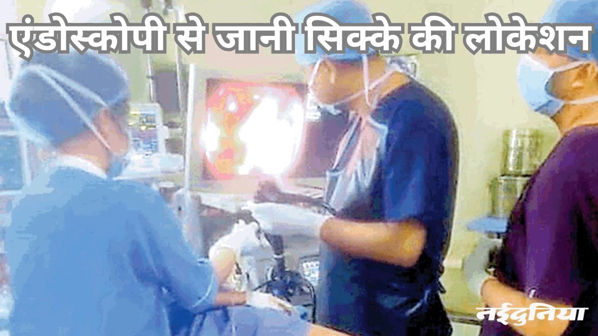 डॉक्टरों की बड़ी सफलता: बच्चे ने निगला सिक्का, बिना ऑपरेशन एंडोस्कोपी के माध्यम से निकाला