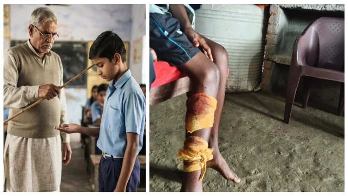बलरामपुर में बेरहमी की हदें पार, प्राथमिक शाला में पहाड़ी कोरवा छात्र की बांस के डंडे से जमकर पिटाई