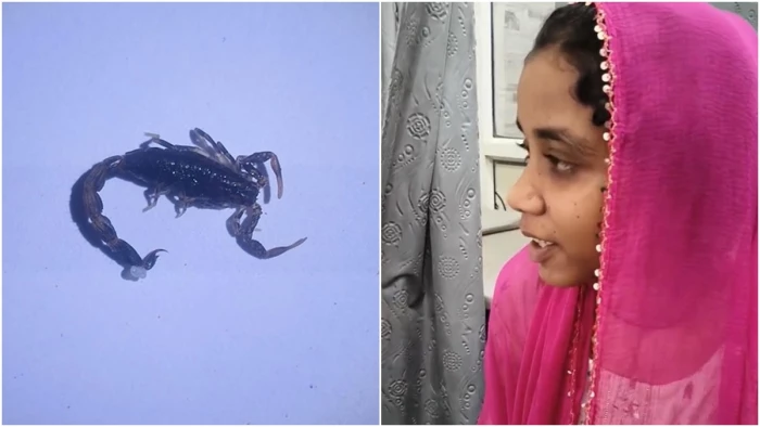 कान में घुसा था बिच्छू, बच्ची समझती रही कीड़ा है; डॉक्टर के पास पहुंचे तो पूंछ पकड़कर बाहर निकाला