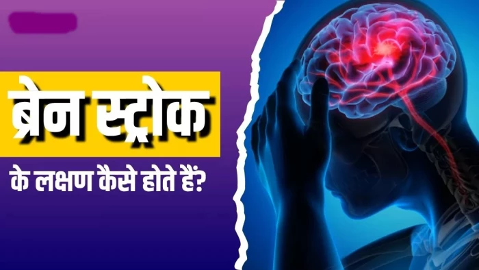 दिमाग की कमजोर नसों पर दबाव डालता है बीपी जिससे वे फट सकती हैं, ब्रेन हेमरेज से बचाव की जानकारी