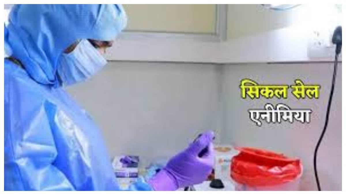 कोरबा में सिकल सेल के 550 मरीज चिन्हित, पेंशन और शिक्षा सहायता का लाभ किसी को नहीं मिल रहा, जानकारी का अभाव