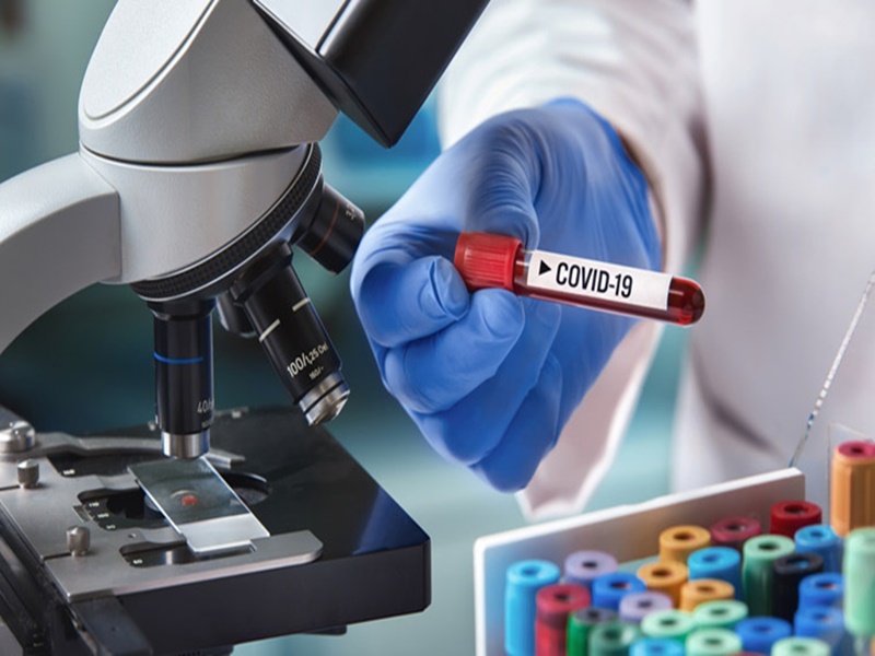 Covid 19 Vaccine : Seven Indian Pharma companies are trying to make Corona  Vaccine