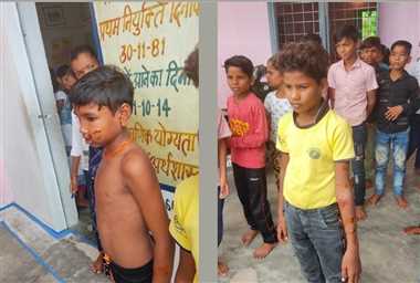 छल्लापुरा में बंदरों का आतंक, स्कूली बच्चों को किया जख्मी