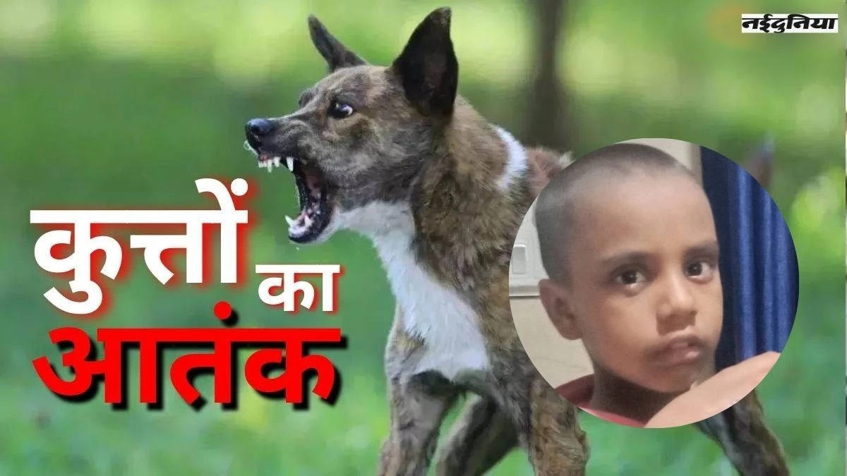 थम नहीं रहा कुत्तों का आतंक... भिलाई में एक बच्ची को कई जगह नोचा