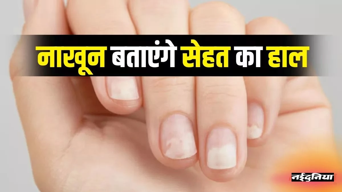 Nails Health Signs: थायरॉइड से लेकर किडनी रोग तक... नाखूनों पर दिखते हैं गंभीर बीमारियों के संकेत, न करें नजरअंदाज