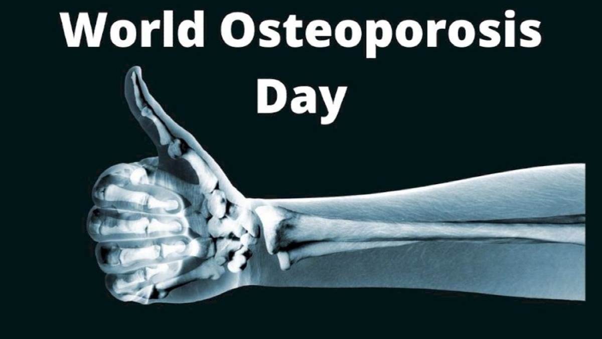 World Osteoporosis Day 2023 इंदौर को लगा हड्डियां टूटने का रोग, मामूली