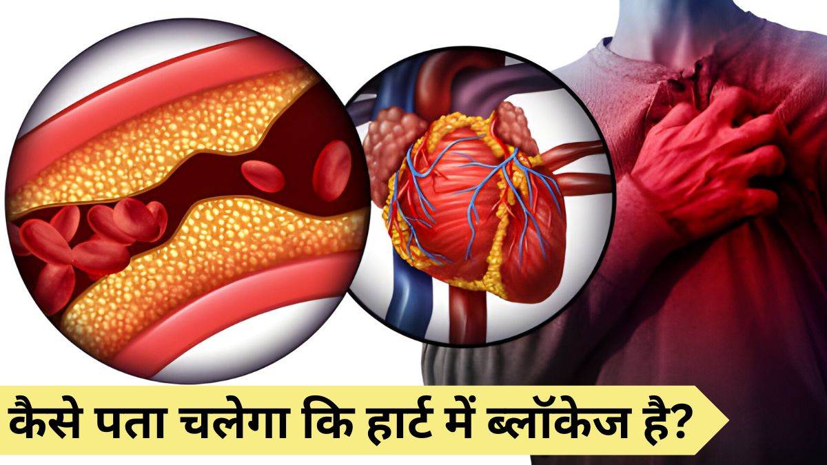 Heart Blockage: घर बैठे कैसे पता लगाएं हार्ट में ब्लॉकेज है या नहीं… यहां जानिए आसान तरीका