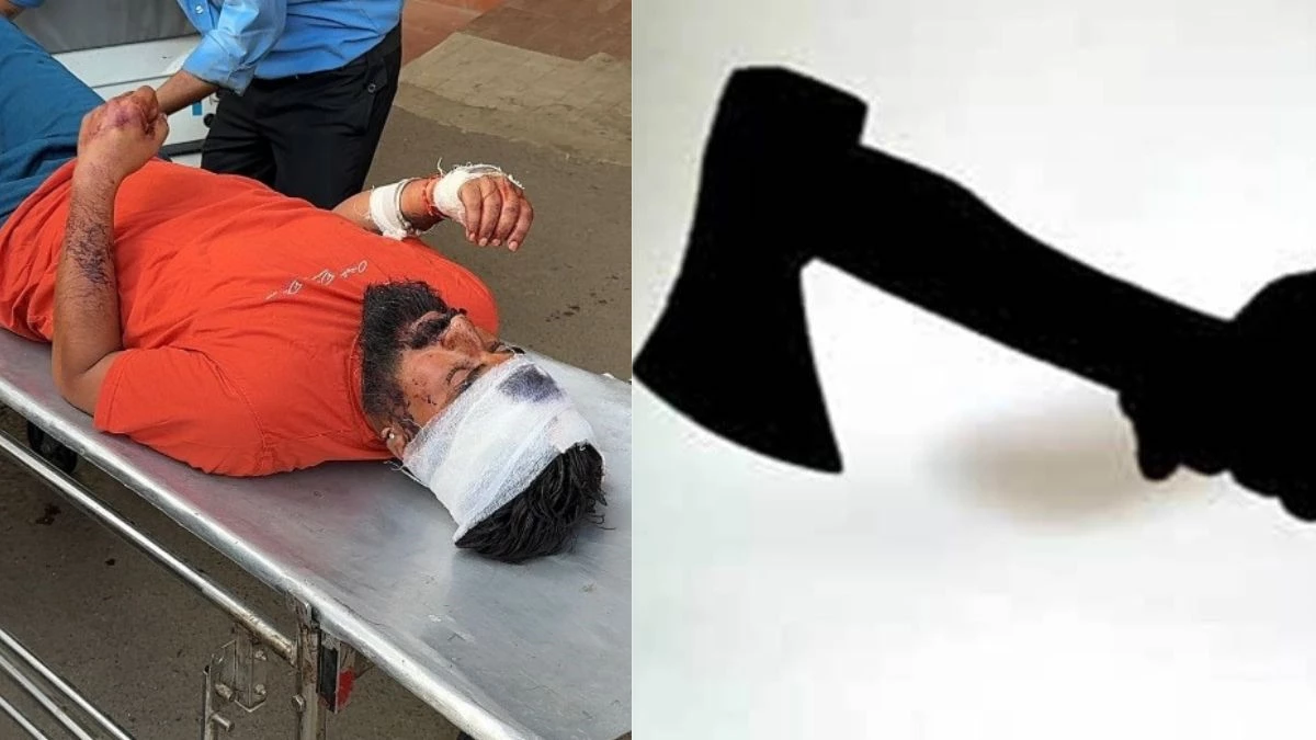 कांवड़ यात्रियों पर धारदार हथियारों से हमला, प्रेम विवाह की रंजिश में बढ़ा विवाद... कुल्हाड़ी से किए वार, 3 घायल