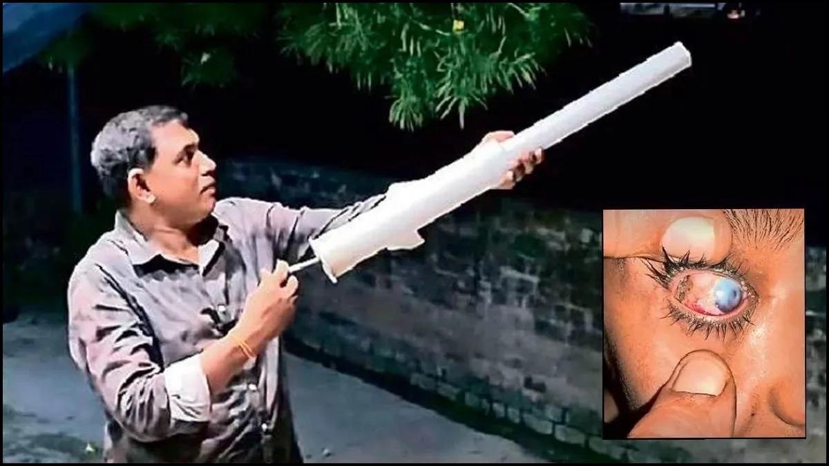 Carbide Gun बनी जानलेवा... MP में 200 से अधिक बच्चों की आंखें घायल, रोशनी के पर्व पर गंवाई 'आंखों की रोशनी'