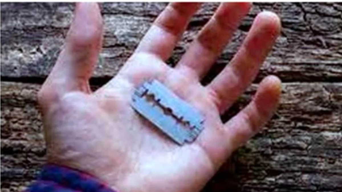 Ujjain News: शराब पिलाने से दोस्त ने किया मना, तो ब्लेड से काट दिया गाल; आरोपी फरार