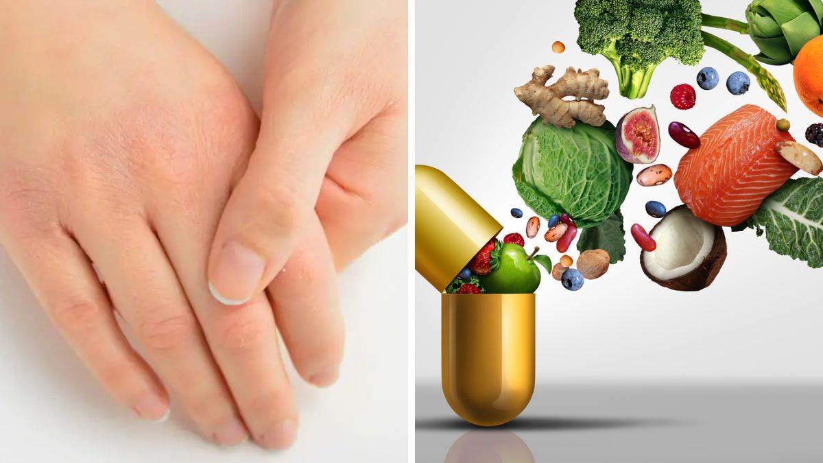 Health Tips: इस विटामिन की कमी से होती है हाथ-पैर में झनझनाहट, जानिए लक्षण और उपाय