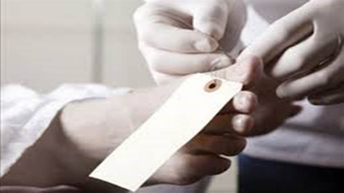 Ambikapur News :  लापरवाही की कीमत जान देकर चुकानी पड़ी युवक को