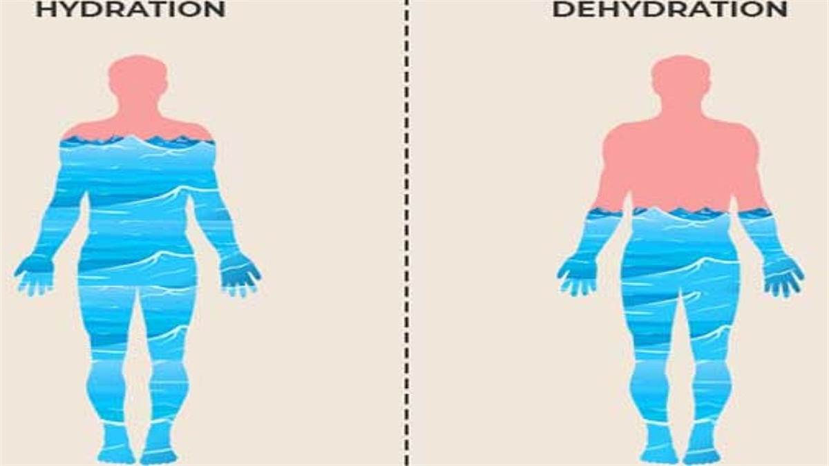 Dehydration News: भीषण गर्मी में डिहाइड्रेशन से बढ़ा दुर्लभ न्यूरोलाजिकल बीमारी साइनस थ्रोंबोसिस का खतरा, जानिए कैसे करें बचाव
