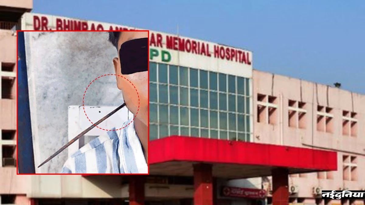 बच्चे के गले में घुसा था तीर जैसा 7 इंच का औजार, डॉक्टरों ने फरिश्ता बन बचायी जान