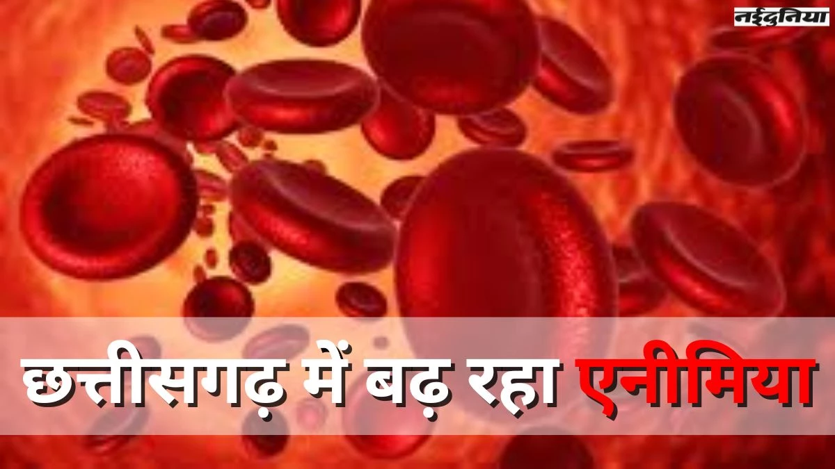 छत्तीसगढ़ में एनीमिया के आंकड़े डराने वाले, 61% से ज्यादा महिलाएं, 27% पुरुष पीड़ित, जानिए लक्षण और इलाज