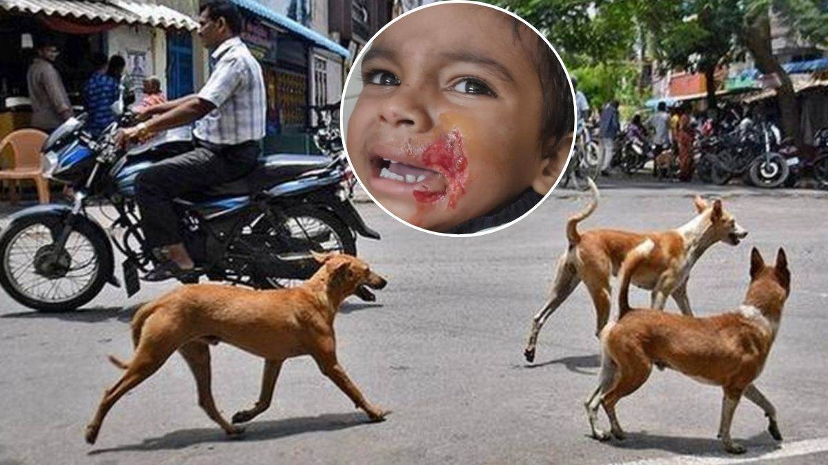 मंडला में आवारा कुत्ताें का आतंक, तीन वर्षीय बालक पर झपटा; काटने से चेहरे पर गंभीर चोट