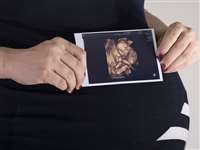 गर्भवती महिलाओं की 4डी अल्ट्रासाउंड स्कैनिंग के आधार पर स्‍टडी में पता चलीं ये चौंकाने वाली रोचक बातें