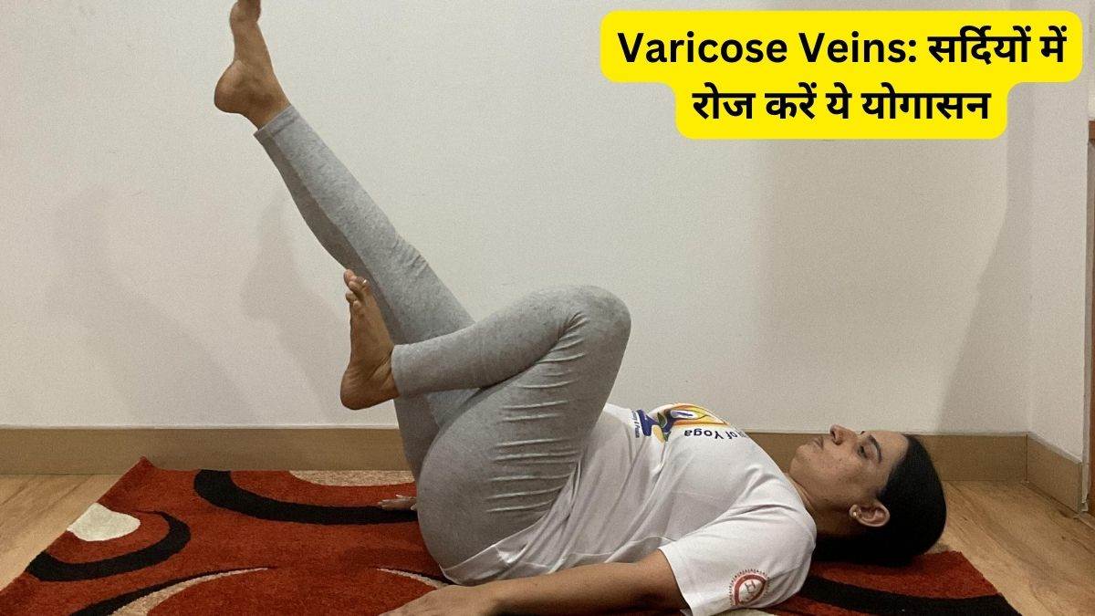 What are the Best Exercises for Varicose Veins? - The Vein Institute