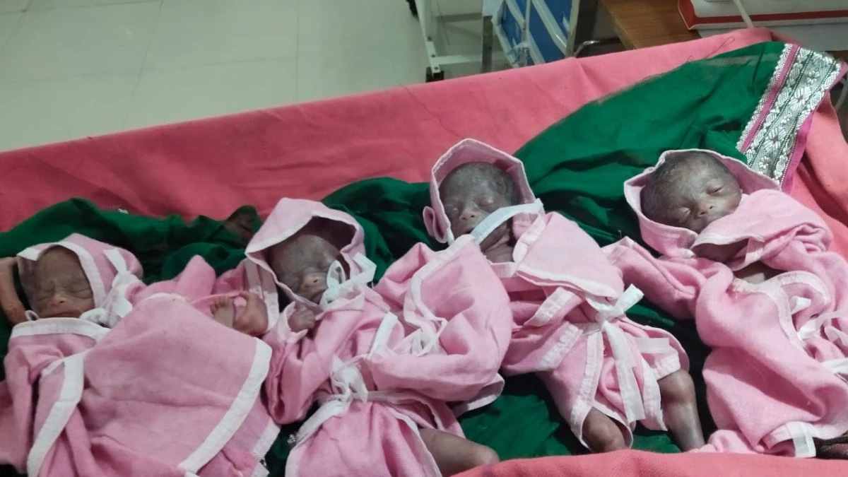 छिंदवाड़ा में एक साथ जन्मे चार बच्चों की मौत, सांस न ले पाने से गई जान; नहीं बने थे फेफड़े