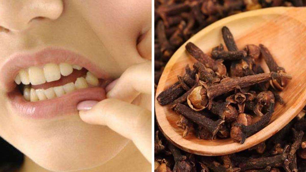 Health Tips आपके किचन में मौजूद है दांतों का डॉक्टर, जानें कैसे करें