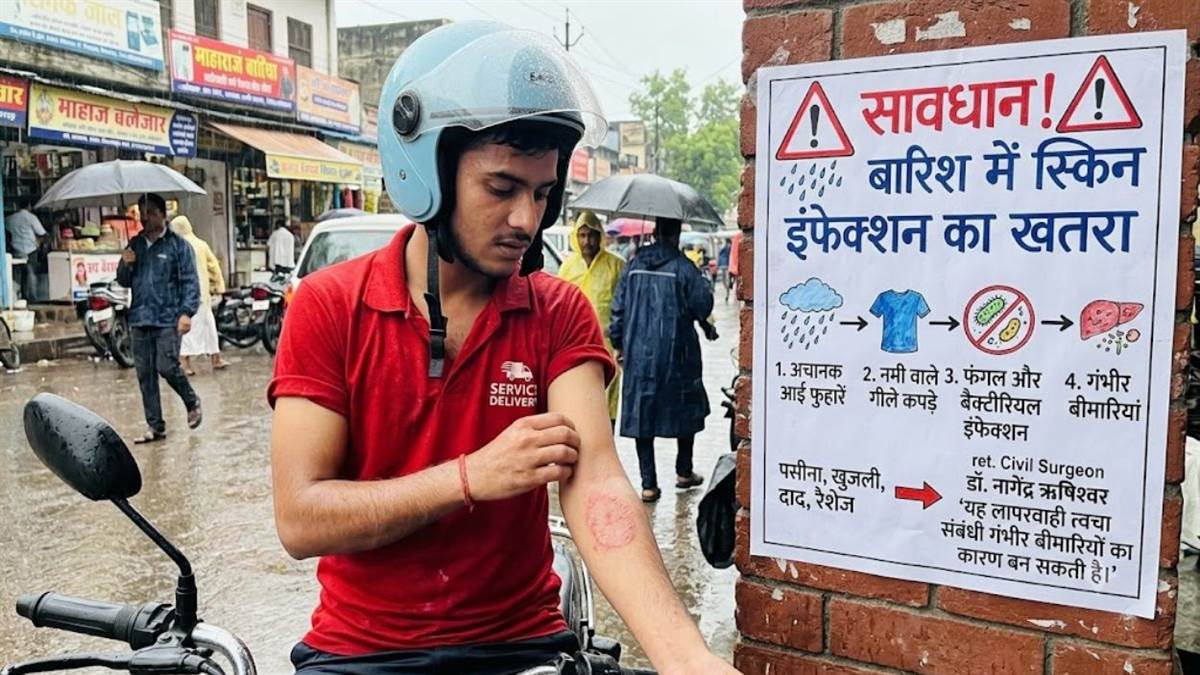 सावधान! बारिश में बढ़ा स्किन इंफेक्शन का खतरा: गीले और नमी वाले कपड़ों से हो सकती हैं गंभीर त्वचा बीमारियां