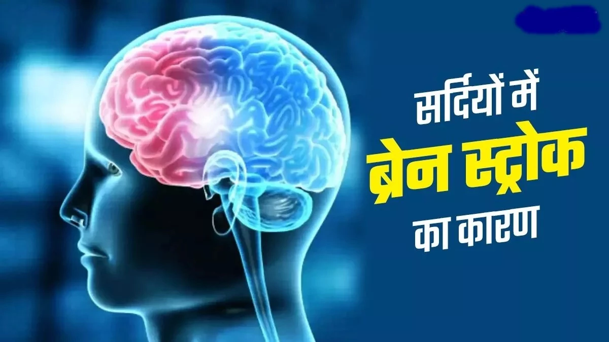 सर्दी का मौसम स्ट्रोक के मरीजों के लिए खतरे की घंटी, लक्षणों को पहचानें
