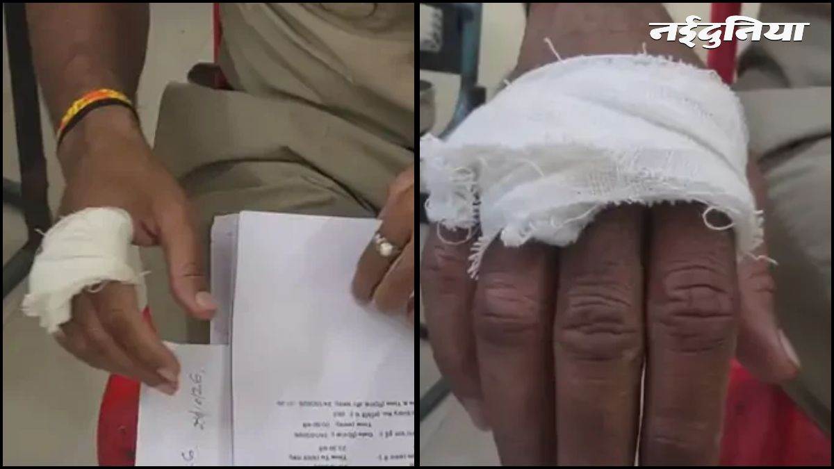 उज्जैन में पुलिस टीम पर हमला... शराब पीने से टोकने पर युवकों ने की मारपीट, कॉन्स्टेबल की कटी उंगली, 3 गिरफ्तार