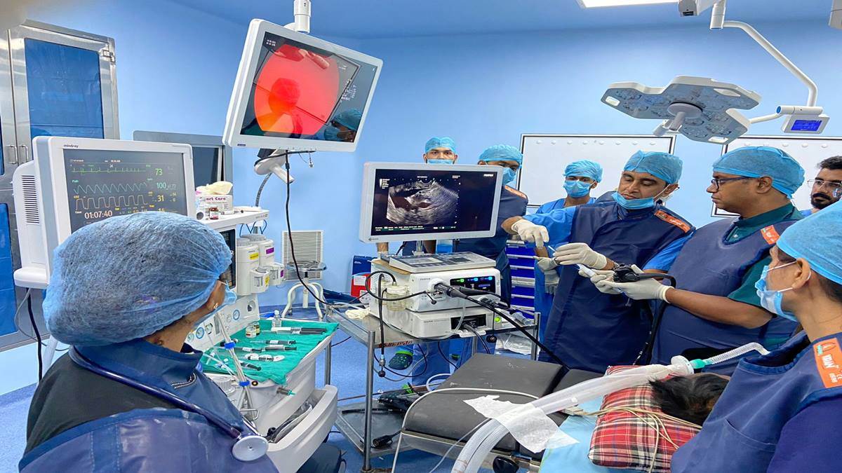 Indore News: सुपर स्पेशिएलिटी अस्पताल के डाक्टरों ने की दुर्लभ सिस्टोगैस्ट्रोस्टोमी सर्जरी