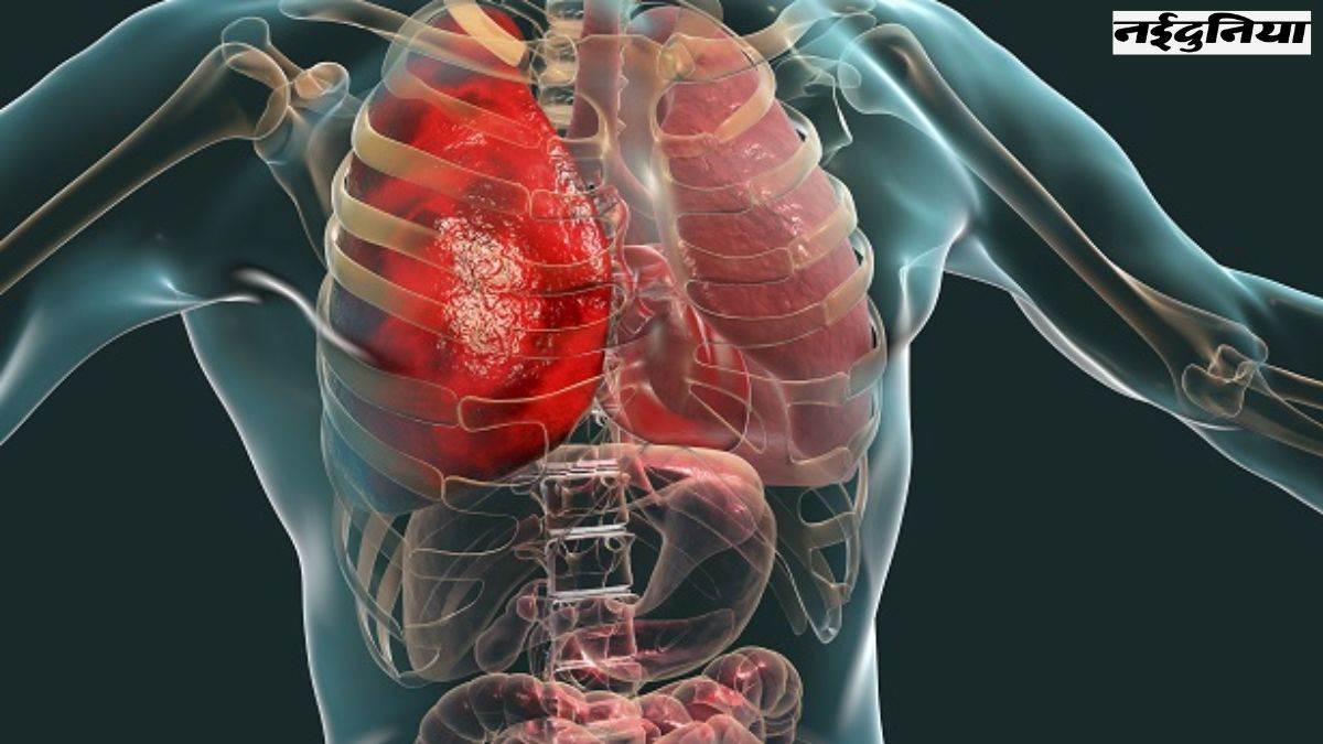 Warmth stroke Aspect Impact: लू लगने से हो सकता है मल्टीपल ऑर्गन फेलियर, इन संकेतों को बिल्कुल न करें अनदेखा