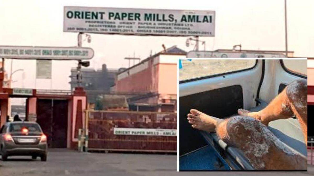 शहडोल की ओरिएंट पेपर मिल अमलाई में वाॅल्व खोलते समय असिस्टेंट ऑपरेटर झुलसा