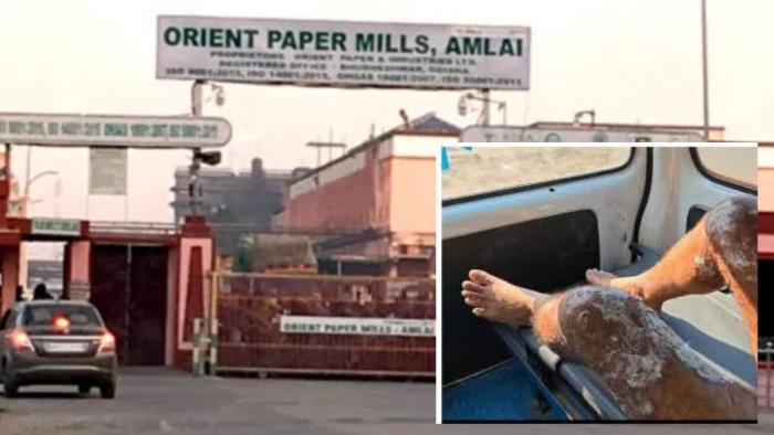 शहडोल की ओरिएंट पेपर मिल अमलाई में वाॅल्व खोलते समय असिस्टेंट ऑपरेटर झुलसा