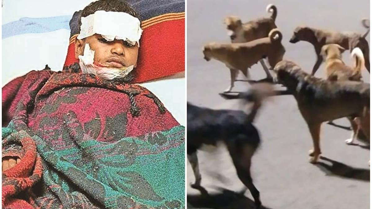Jagdalpur घर के बाहर खेल रहे मासूम को नोच रहा था आवारा कुत्‍ता, तभी