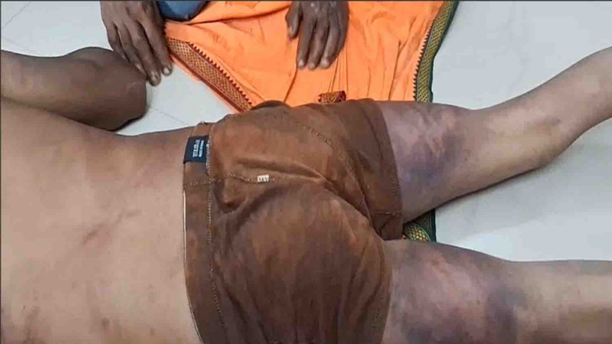कर्मचारी को तीन महीने से नहीं दी सैलेरी, 2 घंटे बनाया बंधक, MP में कांग्रेस विधायक पर मारपीट का आरोप