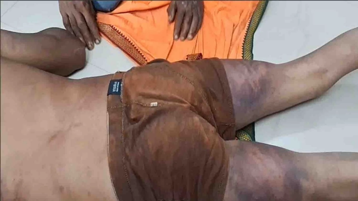 कर्मचारी को तीन महीने से नहीं दी सैलेरी, 2 घंटे बनाया बंधक, MP में कांग्रेस विधायक पर मारपीट का आरोप