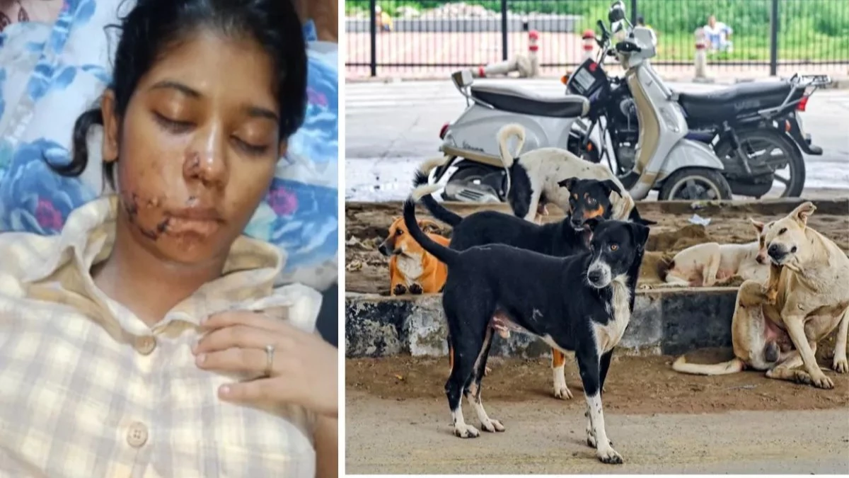 कुत्तों के हमले की शिकार छात्रा को अब डॉग लवर्स से खौफ, घर में घुसकर दी धमकी