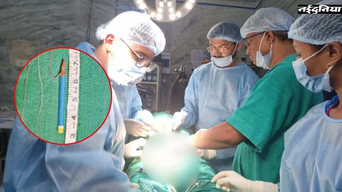 जेल में बंद कैदी ने पेशाब नली में डाला 9cm लंबा पेंसिल, डॉक्टरों ने 3 घंटे के ऑपरेशन के बाद निकाला