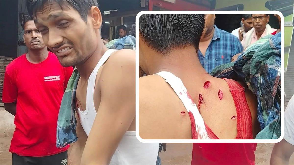 शिवपुरी में दुकान में घुसकर युवक की आंखों में झोंकी मिर्च, फिर ताबड़तोड़ मारे 5 चाकू; आरोपी फरार
