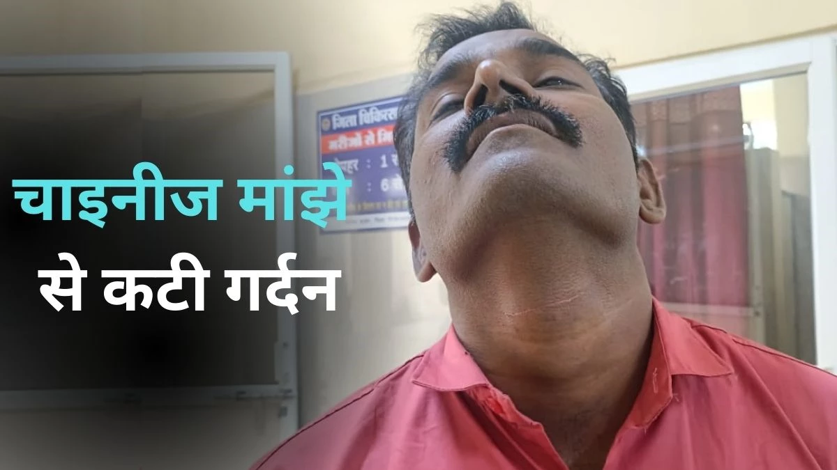 चाइनीज मांझे से बाइक सवार की गर्दन से कटी, खंडवा में एक ही दिन में 9 बच्चों को कुत्तों ने काटा