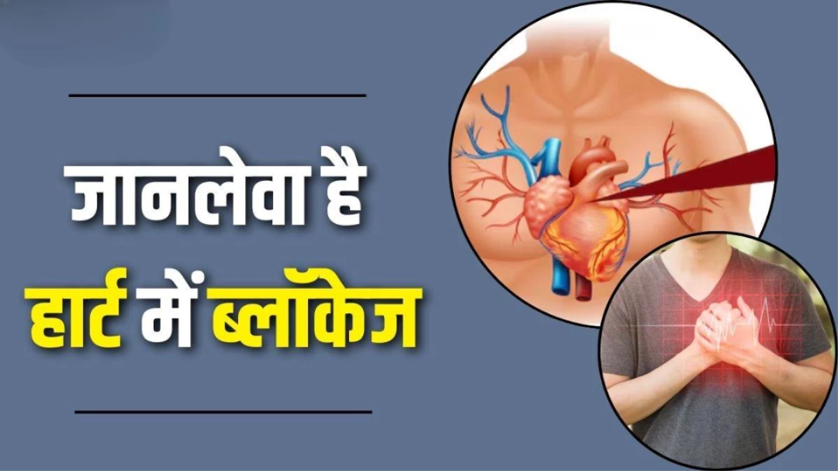 आर्टरी ब्लॉक होने पर हार्ट देता है ये 6 संकेत, भूलकर भी न करे नजरअंदाज; वरना बढ़ जाएगा Heart Attack का खतरा