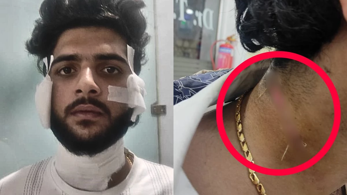 रायपुर सेंट्रल जेल में गैंगवार... यश शर्मा हत्याकांड के मुख्य गवाह पर जानलेवा हमला, भीतर चला चाकू