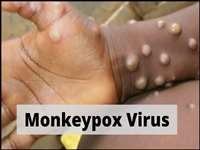 Monkeypox: 15 देशों में पहुंचा मंकीपॉक्स, स्वास्थ्य मंत्रालय ने राज्यों को जारी की ये एडवाइजरी