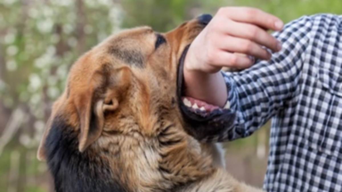 What To Do On Dog Bite: कुत्ते के काटने पर सबसे पहले क्‍या करना चाहिए, एक्‍सपर्ट से जानिए उपचार