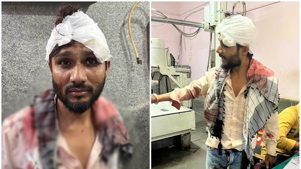 रायपुर में चाकूबाजी: पुरानी रंजिश को लेकर निगरानी बदमाश ने किया चाकू से हमला, दो युवक घायल