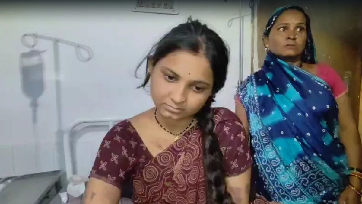 खरगोन में नवविवाहिता के साथ पति ने की हैवानियत, चाकू को गर्म कर शरीर में जगह-जगह दागा